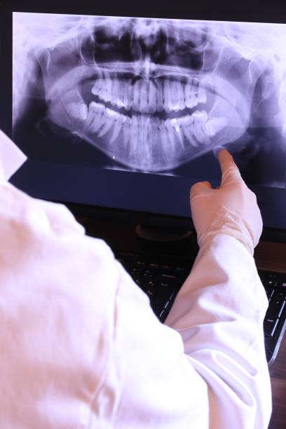 Teeth Whitening in WI