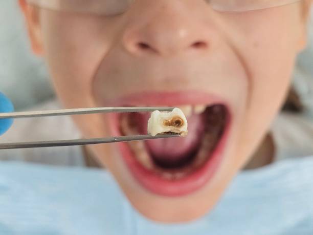 Best Teeth Whitening  in Holmen, WI
