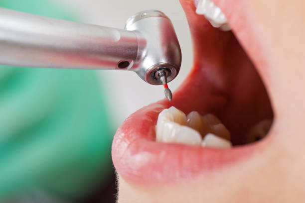 Best Knocked-Out Tooth Emergency  in Holmen, WI